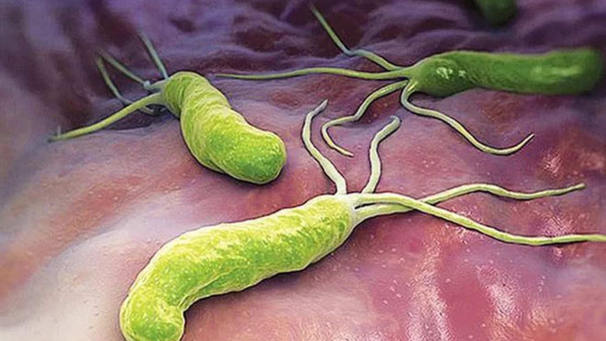 Ngăn ngừa vi khuẩn HP nhờ thực phẩm - yensaovinhphuoc (1)