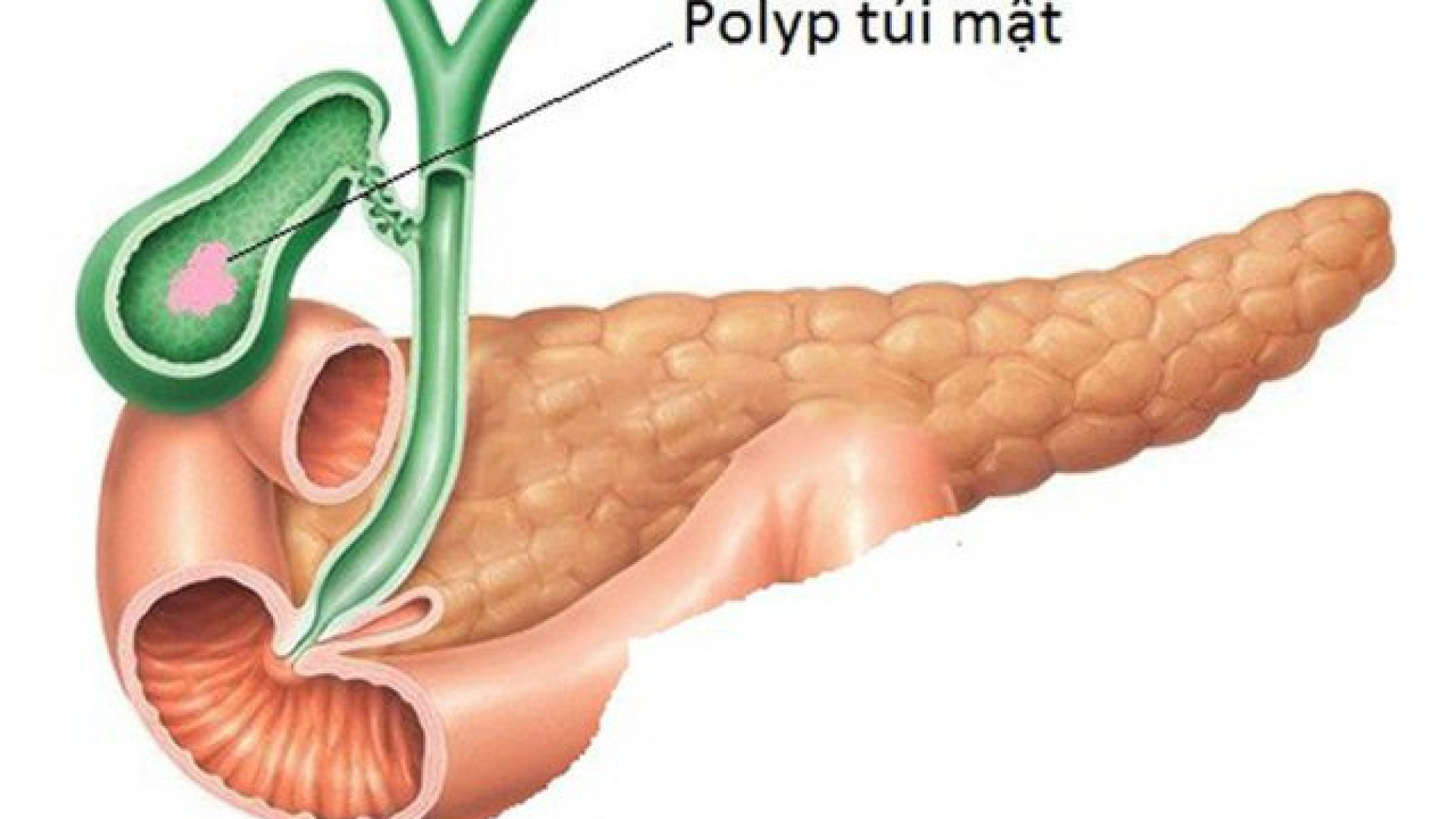polyp-tui-mat-165573615993034206792