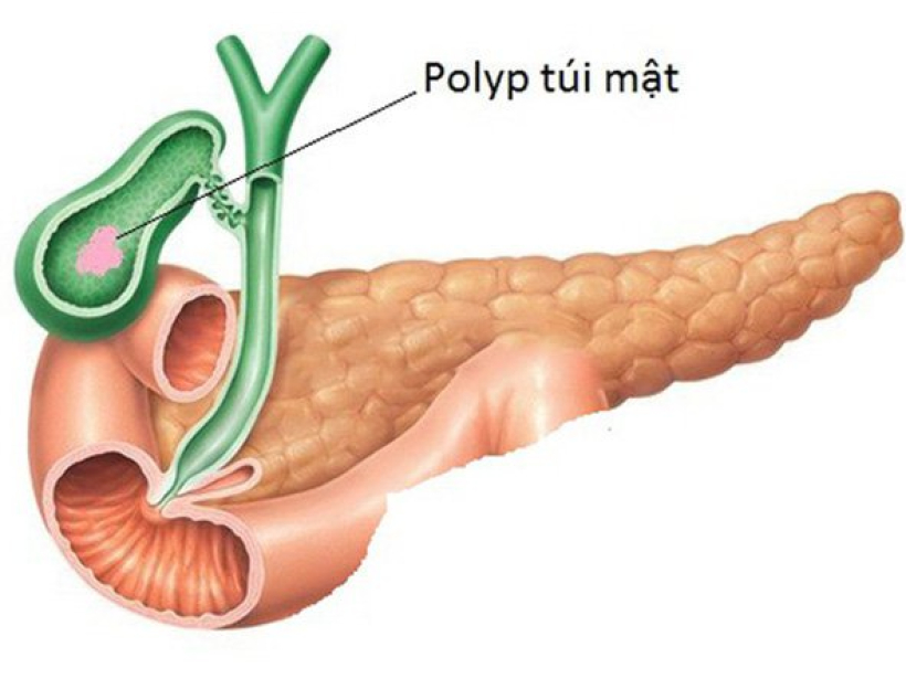 polyp-tui-mat-165573615993034206792