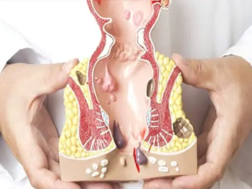 Phuong-phap-chua-benh-tri-tai-anh-an-toan-hieu-qua-yen-sao-yensaovinhphuoc (1)