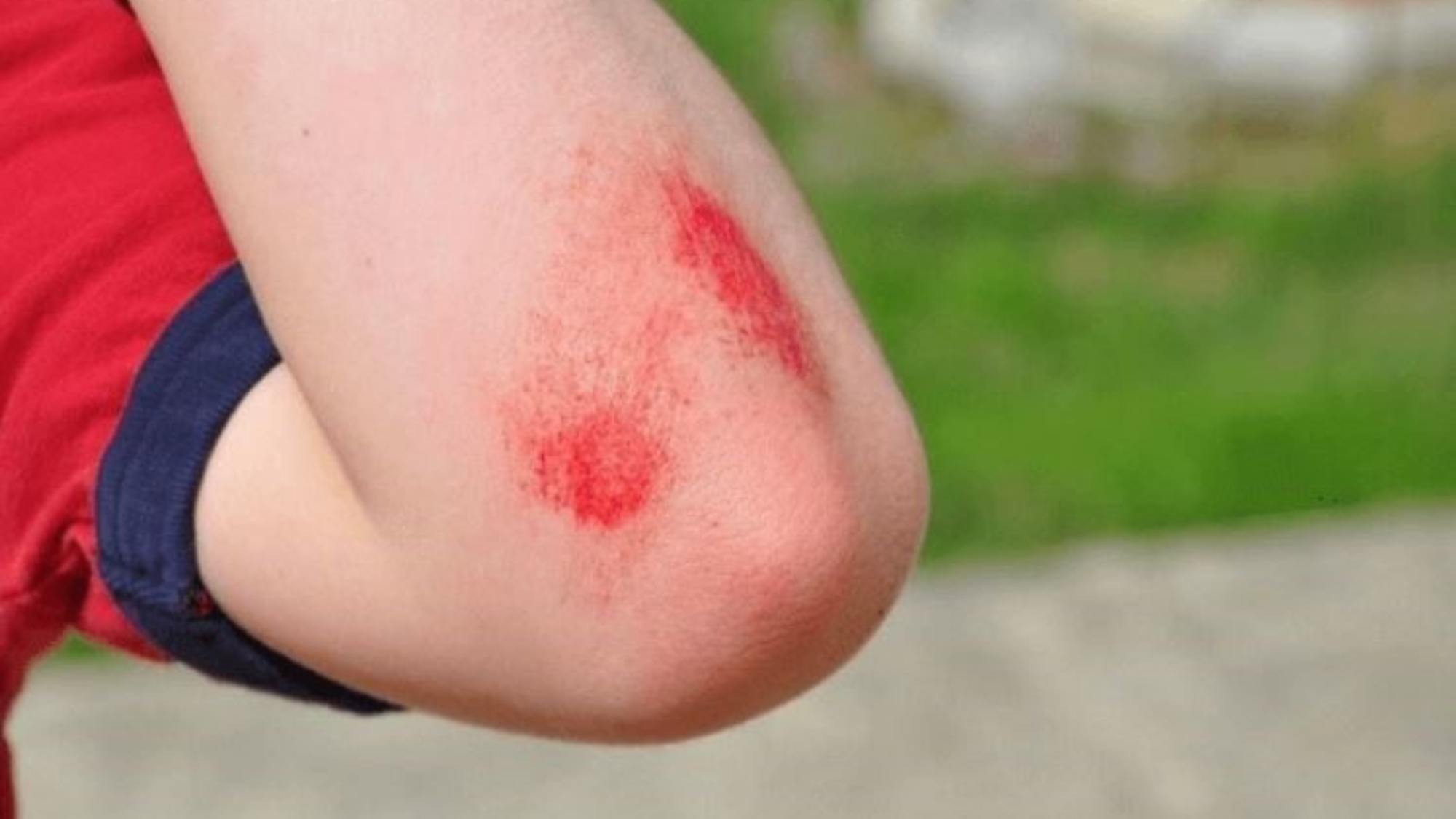 bi-quyet-xu-ly-nhanh-lien-vet-thuong-khong-de-lại-seo-yensaovinhphuoc.vn