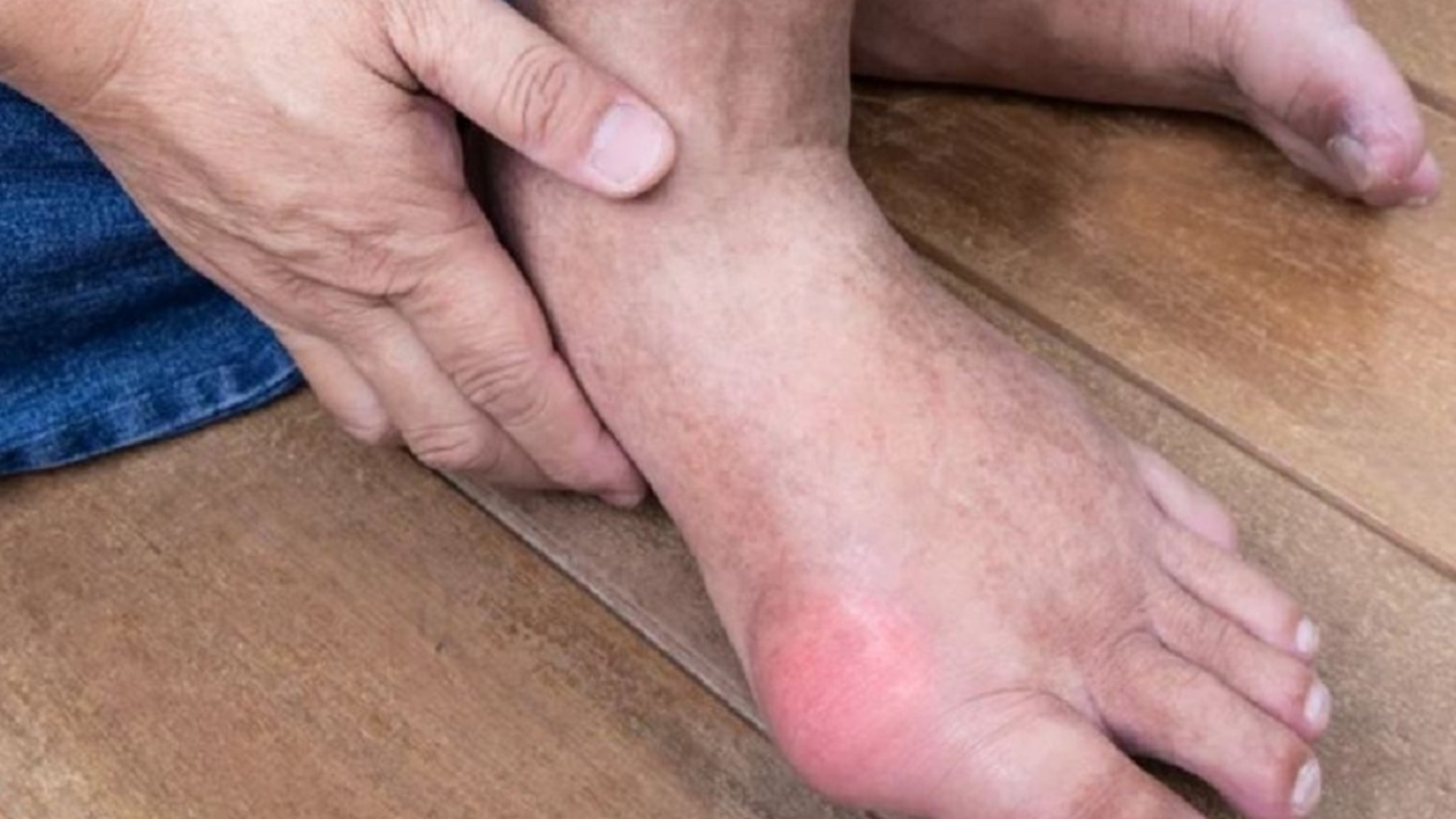 thuc-pham-khuyen-dung-cho-nguoi-benh-gout-yensaovinhphuoc.vn