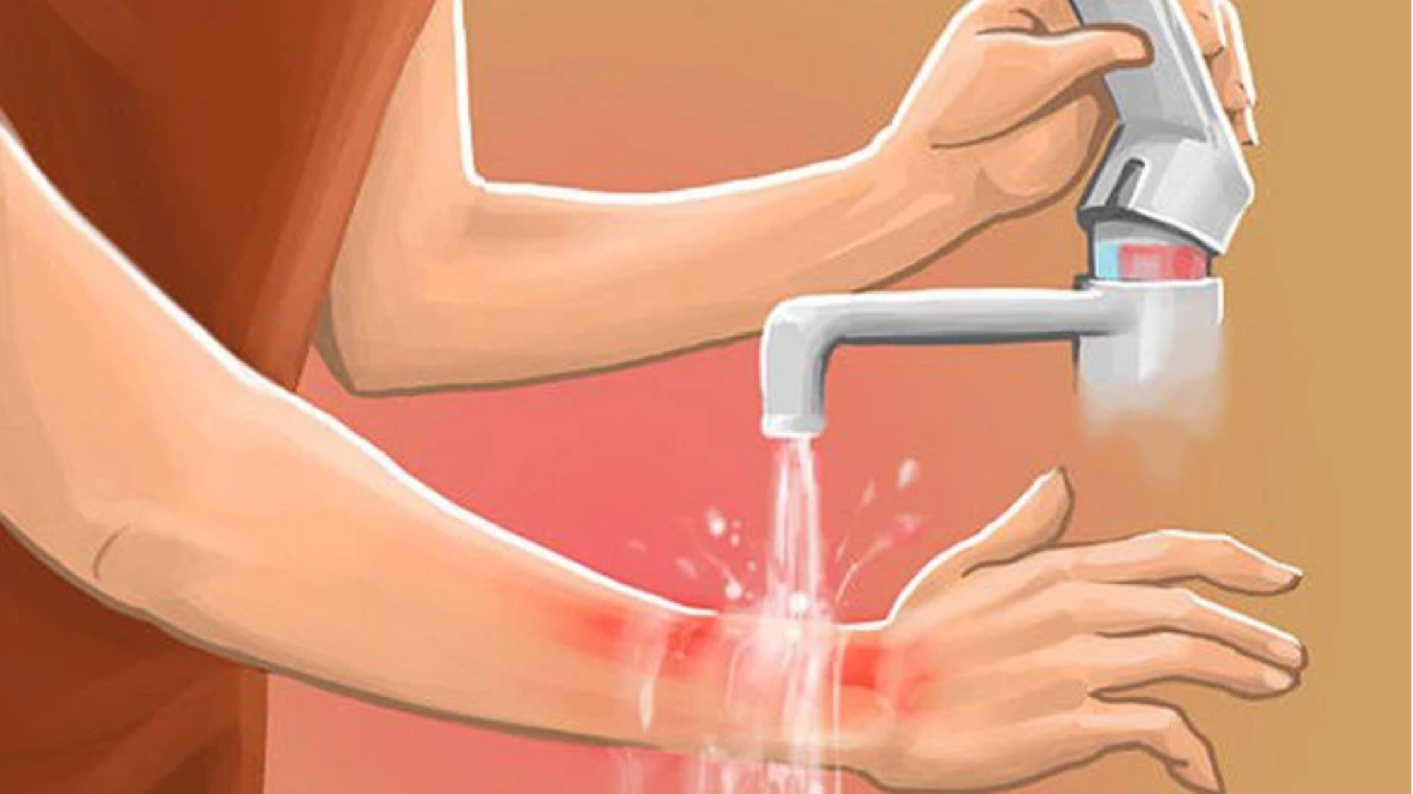 bi-bong-nen-an-gi-va-nen-kieng-an-gi-yensaovinhphuoc.vn