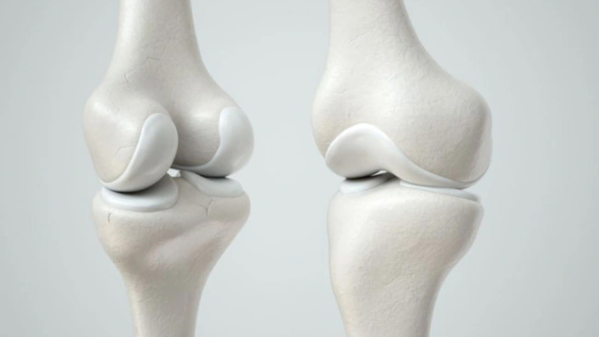 thuc-pham-ho-tro-tai-tao-sun-khop-hieu-qua-yensaovinhphuoc.vn