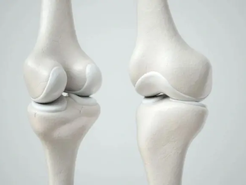 thuc-pham-ho-tro-tai-tao-sun-khop-hieu-qua-yensaovinhphuoc.vn