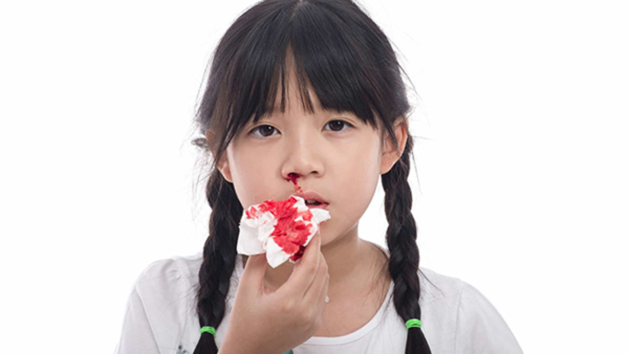 tre-bi-chay-mau-cam-nen-an-gi-yensaovinhphuoc