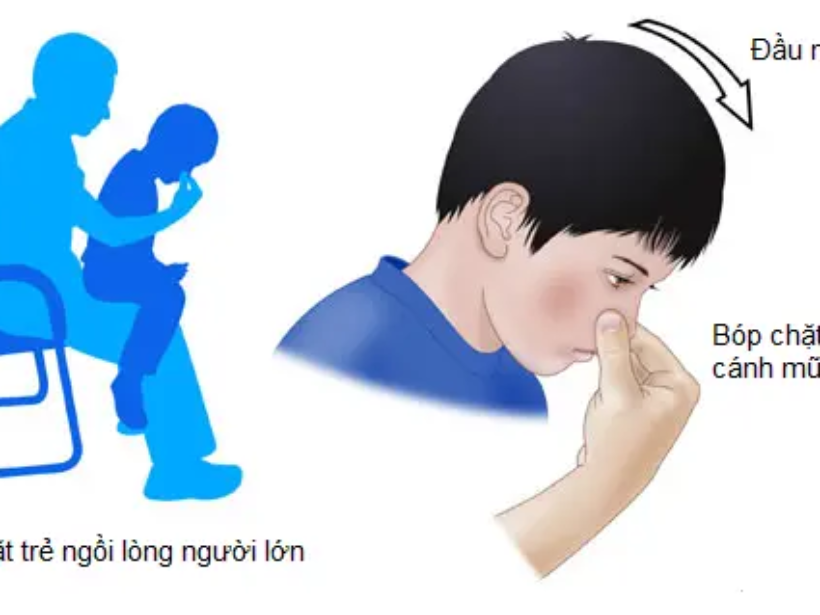 tre-bi-chay-mau-cam-nen-an-gi-yensaovinhphuoc