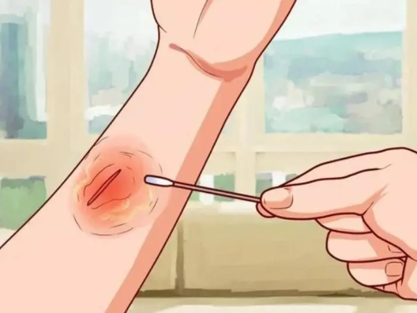 vat-thuong-ho-co-an-yen-sao-duoc-khong-yensaovinhphuoc.vn