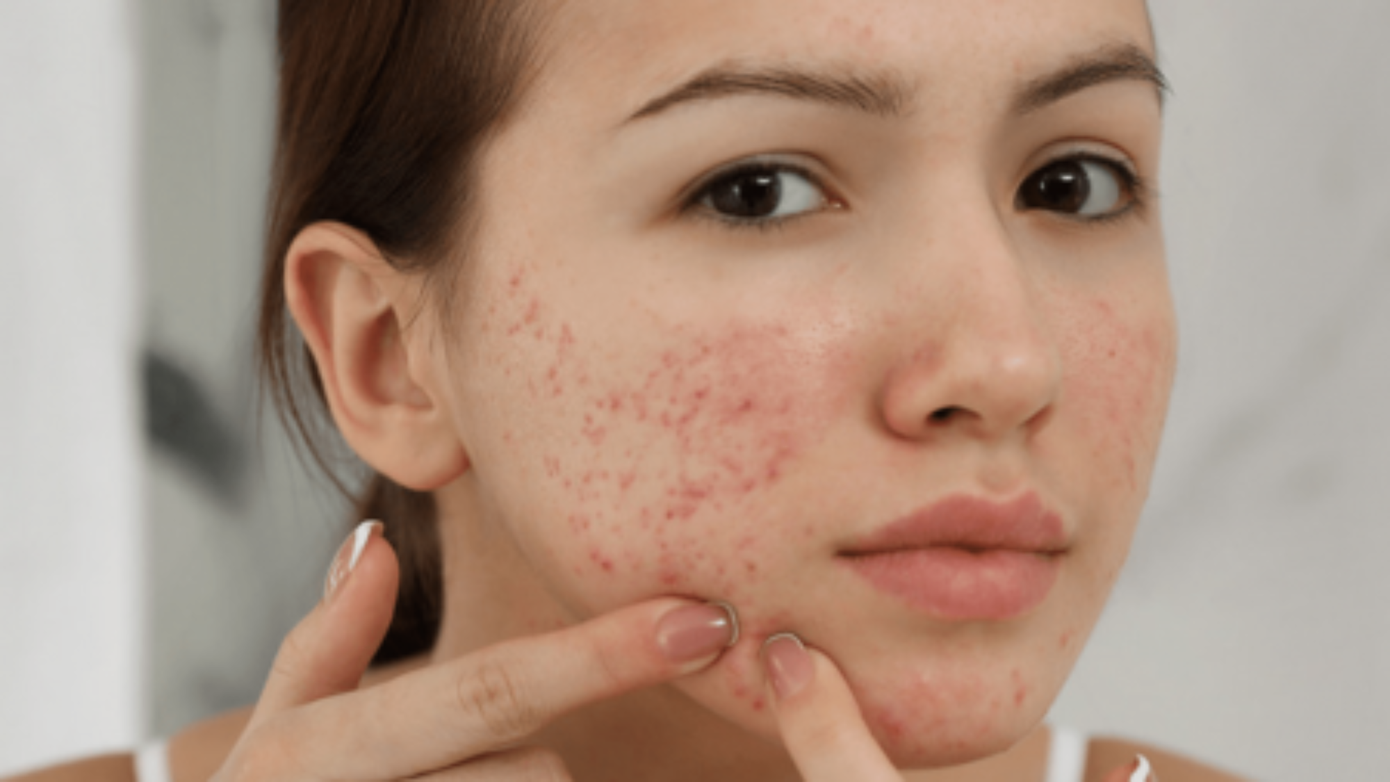 bi-mun-nen-an-gi-de-giai-nhiet-dep-da-yensaovinhphuoc