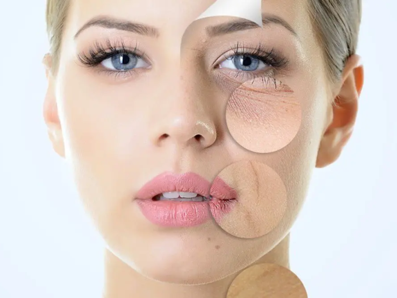 4-dau-hieu-lao-hoa-da-ban-nen-biet-yensaovinhphuoc (1)